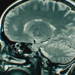 Cannabinoids-by-themselves-can-mimic-some-effects-of-cannabis