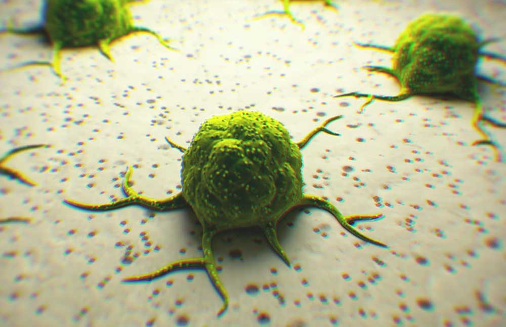 Could Patients with Kidney Cancer Find Support in Cannabis and Cannabinoids