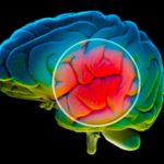 Alzheimer’s Symptoms May be Checked through Antibiotics