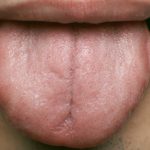 Dry-mouth-Tips-for-wetting-your-whistle