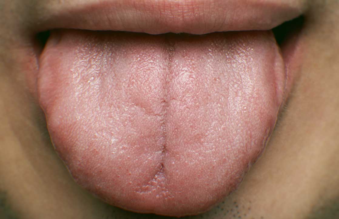Dry Mouth? Tips For Wetting Your Whistle