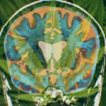 How-cannabis-treats-Huntingtons-disease