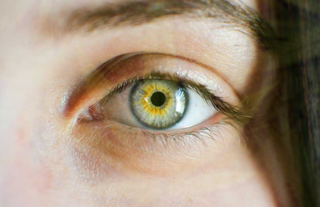 How Cannabis Treats Glaucoma