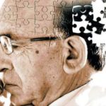 Alzheimer