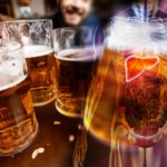 Liver-Damage
