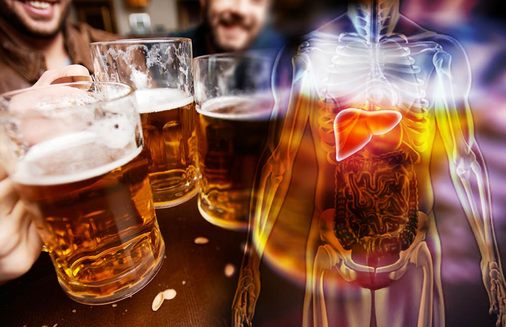 alcohol liver damage