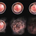 Apoptosis